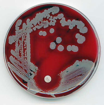 Una cultura microbiologica analisi microbiologiche culture